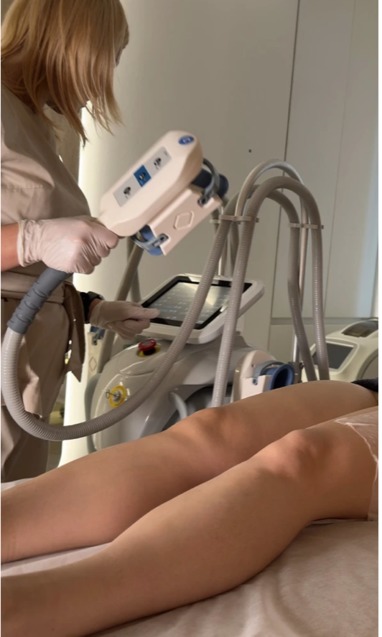 Криолиполиз — холод, который меняет контуры вашего тела 1/1