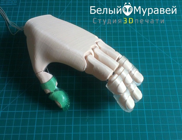 3D-друк у напрямку протезування